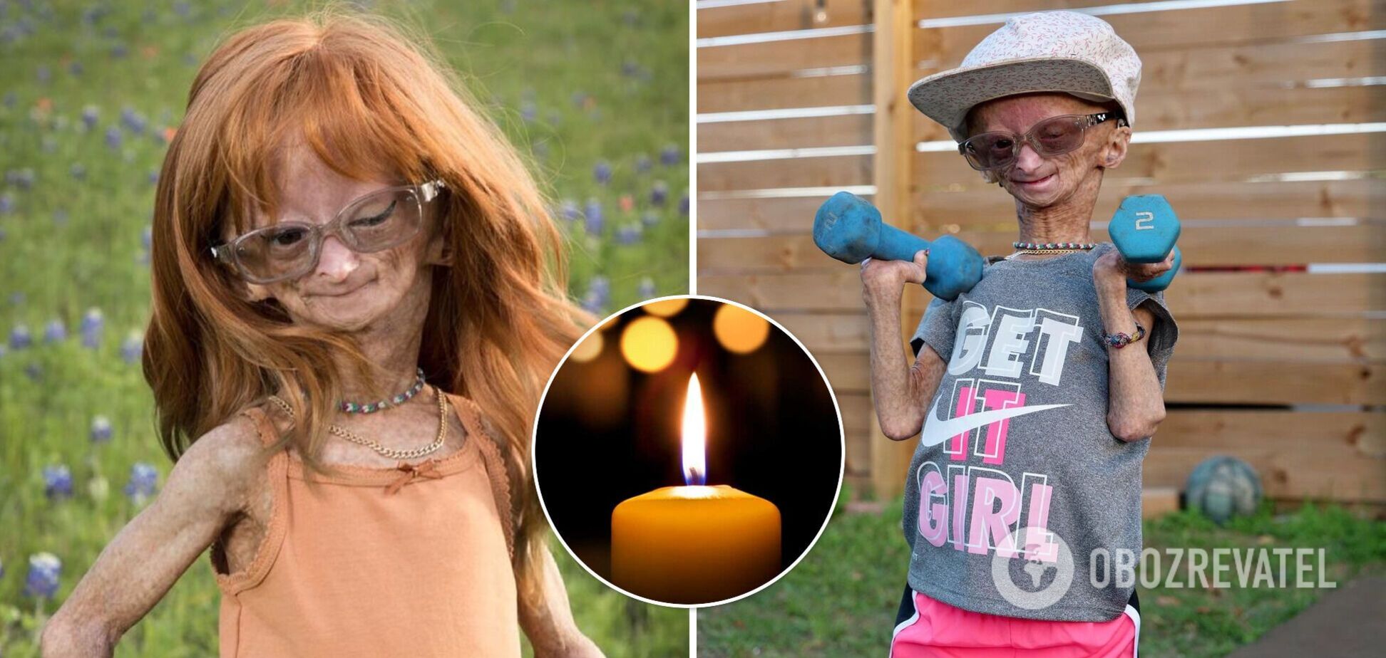 Померла 15-річна дівчинка та зірка YouTube з обличчям 'бабусі'